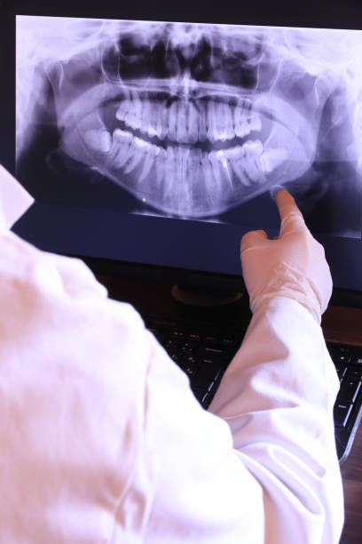 Best Emergency Dental Care for Broken or Chipped Teeth in Southmayd, TX