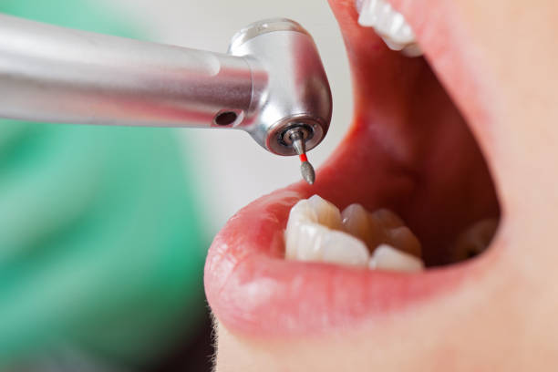 Best Urgent Care for Lost Fillings or Crowns in Southmayd, TX
